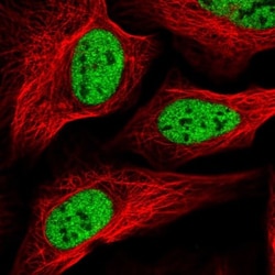 SCAF8/RBM16 Antibody, Novus Biologicals 0.1mL; Unlabeled:Antibodies, Polyclonal